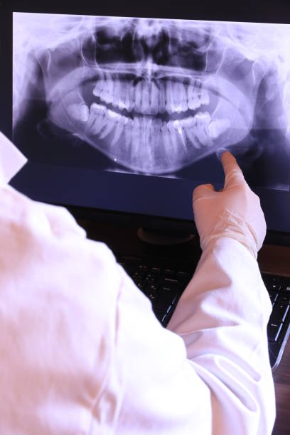 Best Emergency Root Canal Treatment in Fort Davis, TX
